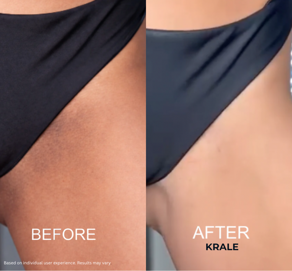 ThighBright Repair System™